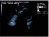 20011217-simon-ultrasound-600.jpg (43117 bytes)